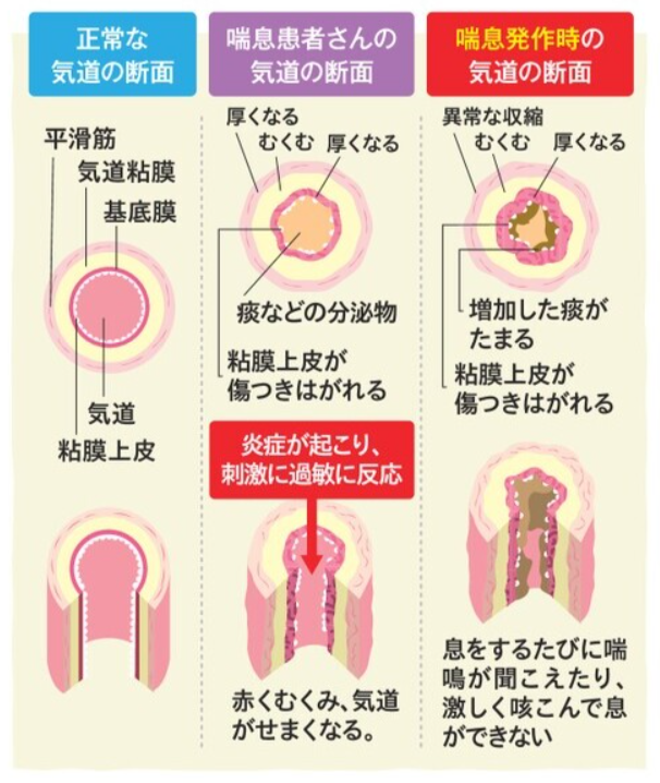 喘息のメカニズム.png